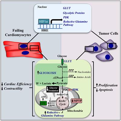 A Similar Metabolic Profile Between the Failing Myocardium and Tumor Could Provide Alternative Therapeutic Targets in Chemotherapy-Induced Cardiotoxicity